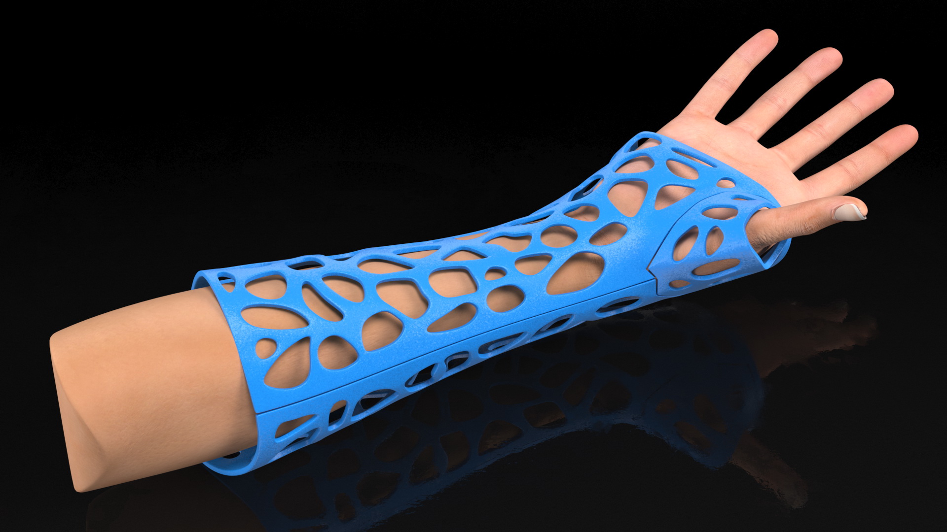 3D-Printed Orthopedic Cast On Hand 3D model
