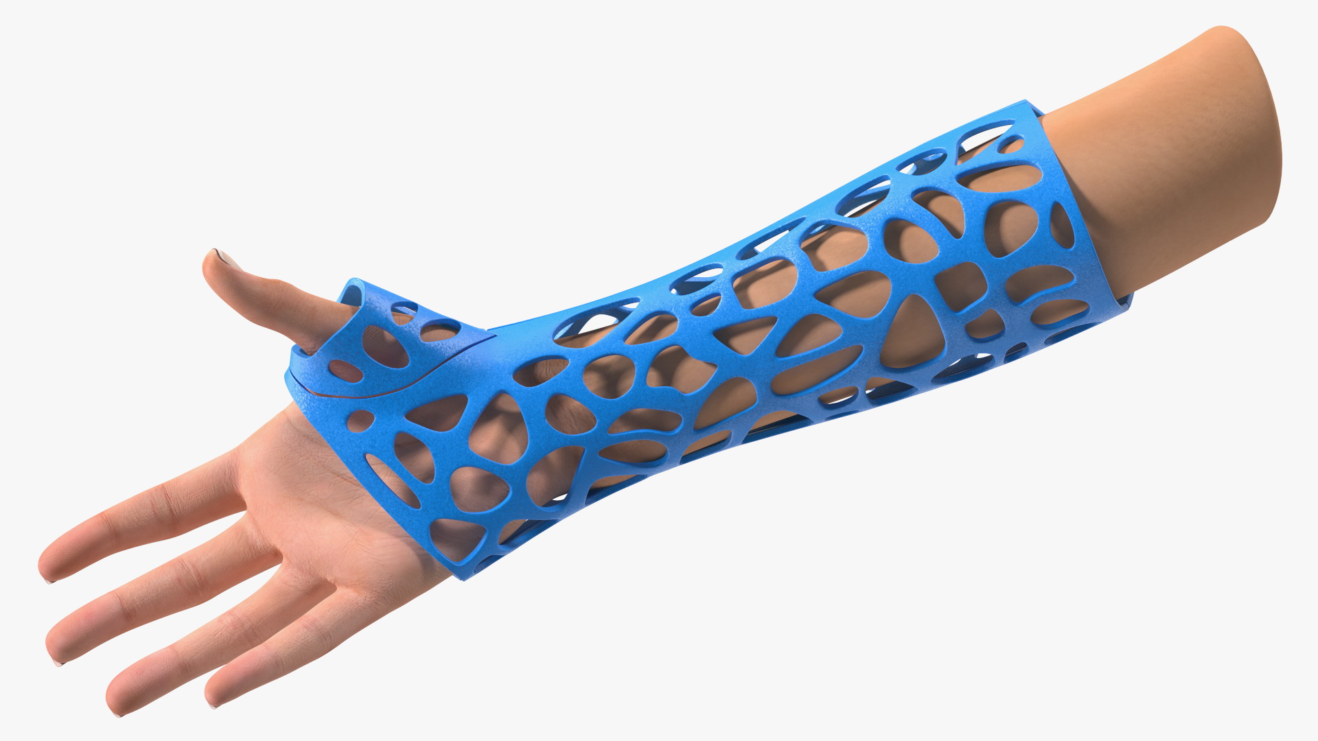 3D-Printed Orthopedic Cast On Hand 3D model