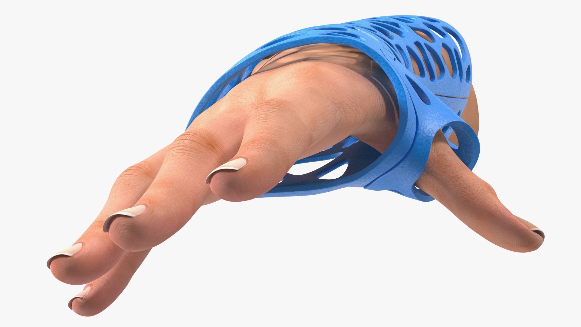 3D-Printed Orthopedic Cast On Hand 3D model