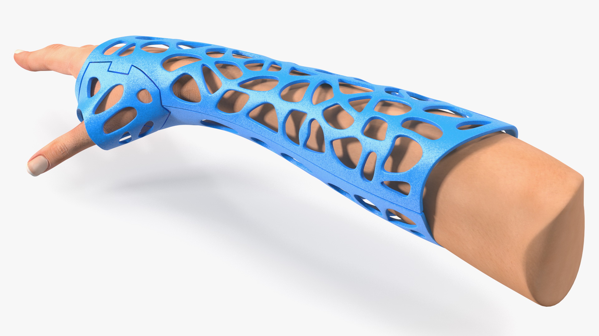 3D-Printed Orthopedic Cast On Hand 3D model