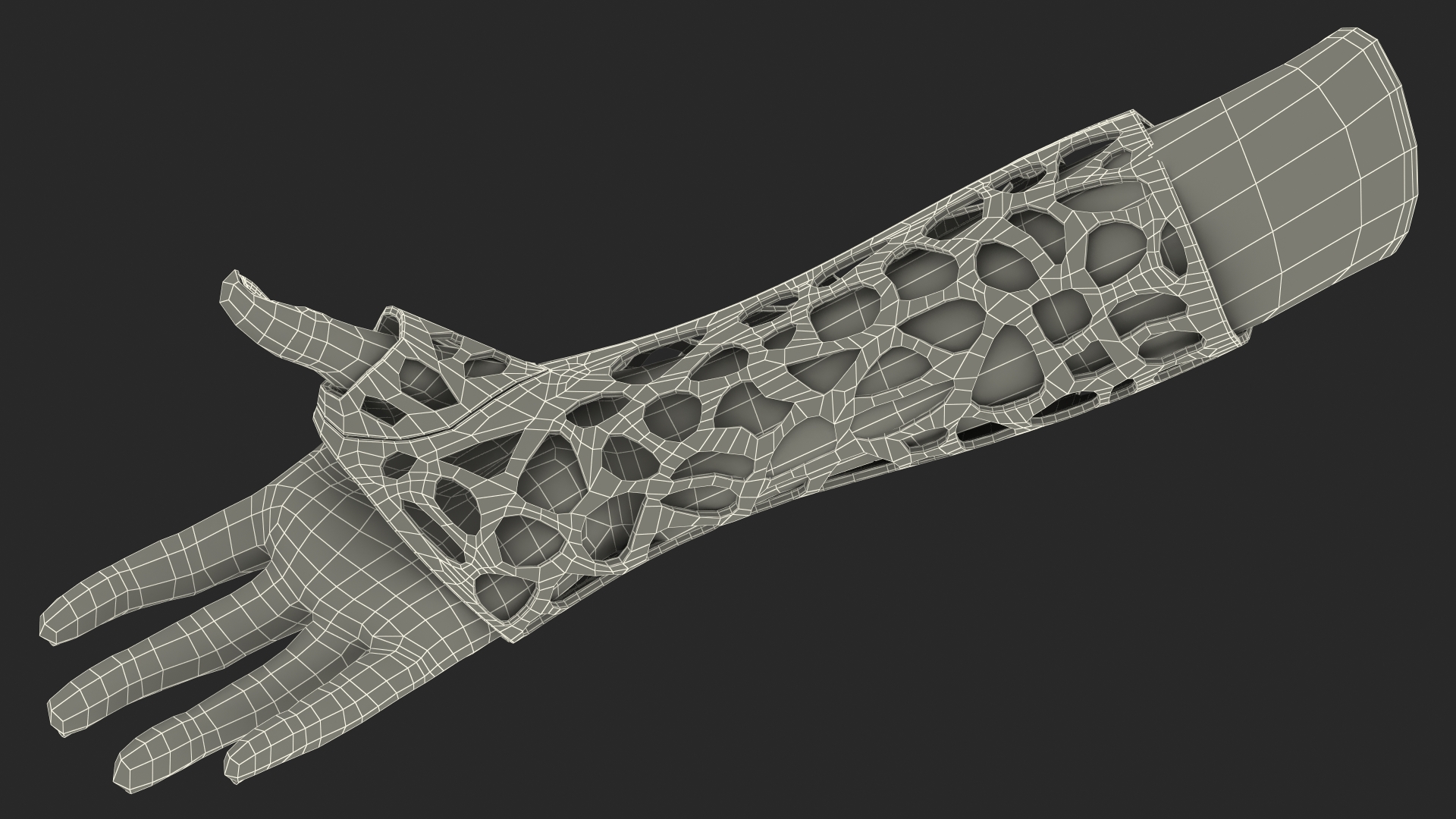 3D-Printed Orthopedic Cast On Hand 3D model