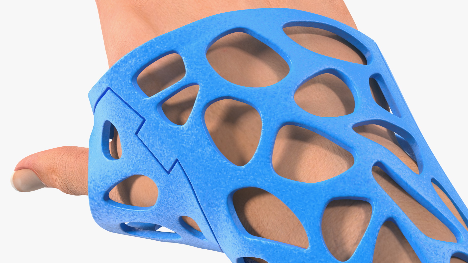 3D-Printed Orthopedic Cast On Hand 3D model