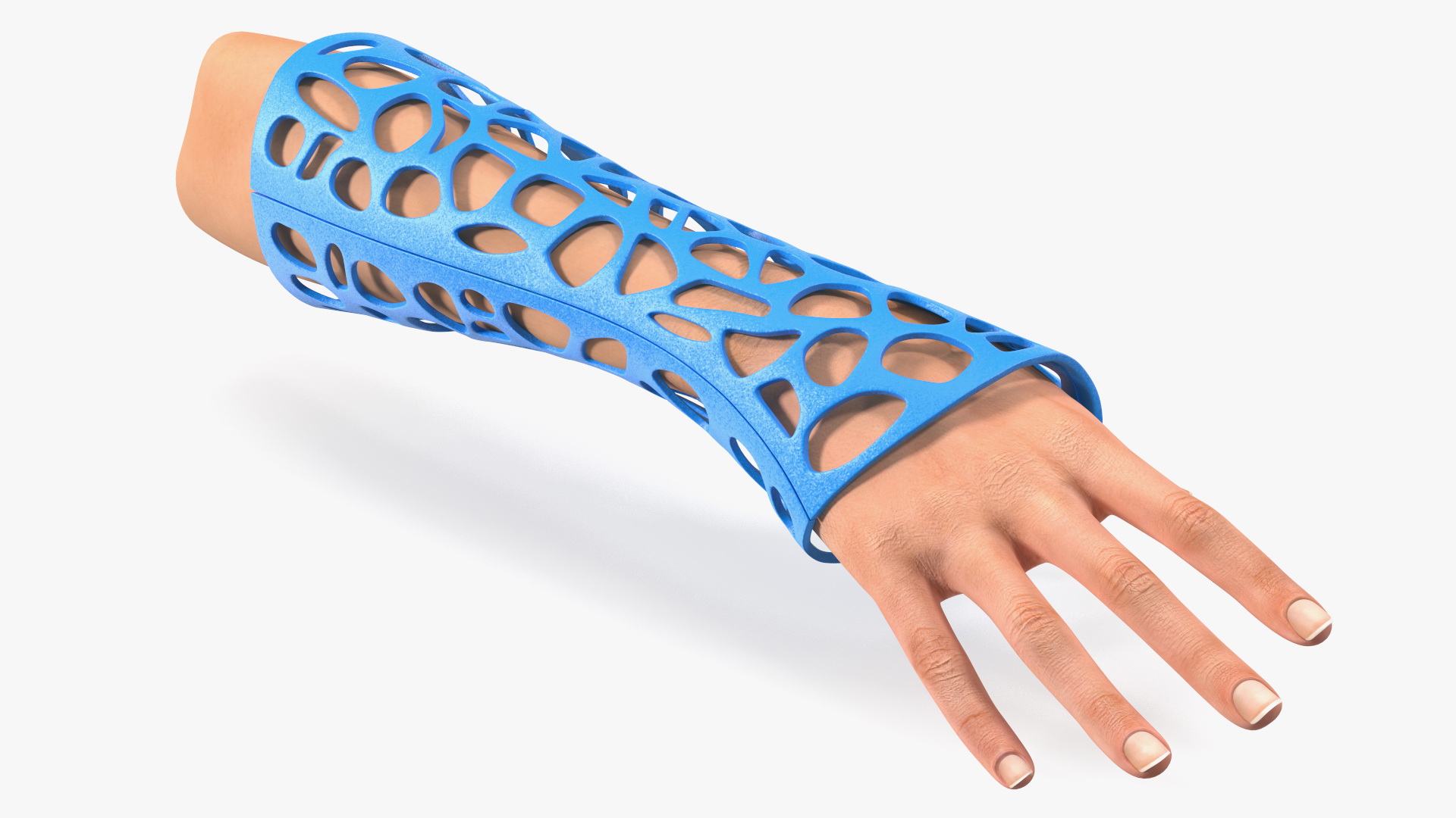 3D-Printed Orthopedic Cast On Hand 3D model