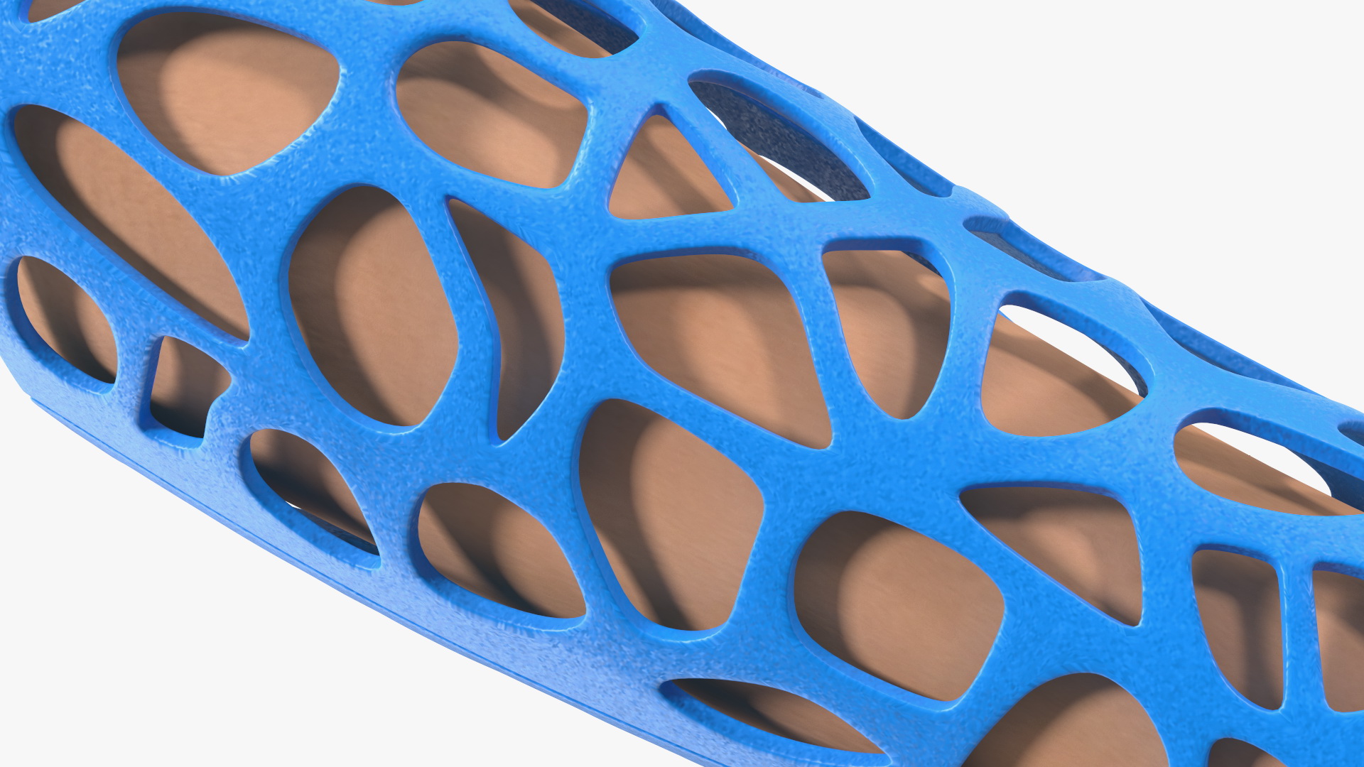 3D-Printed Orthopedic Cast On Hand 3D model