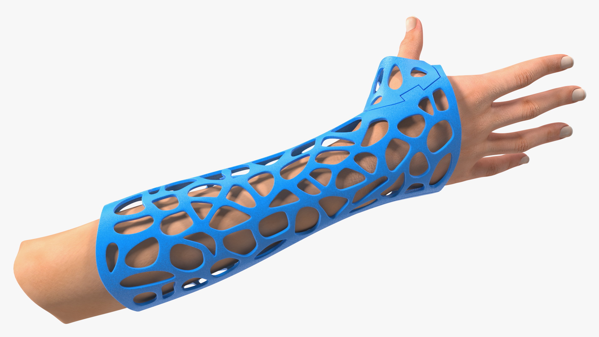 3D-Printed Orthopedic Cast On Hand 3D model