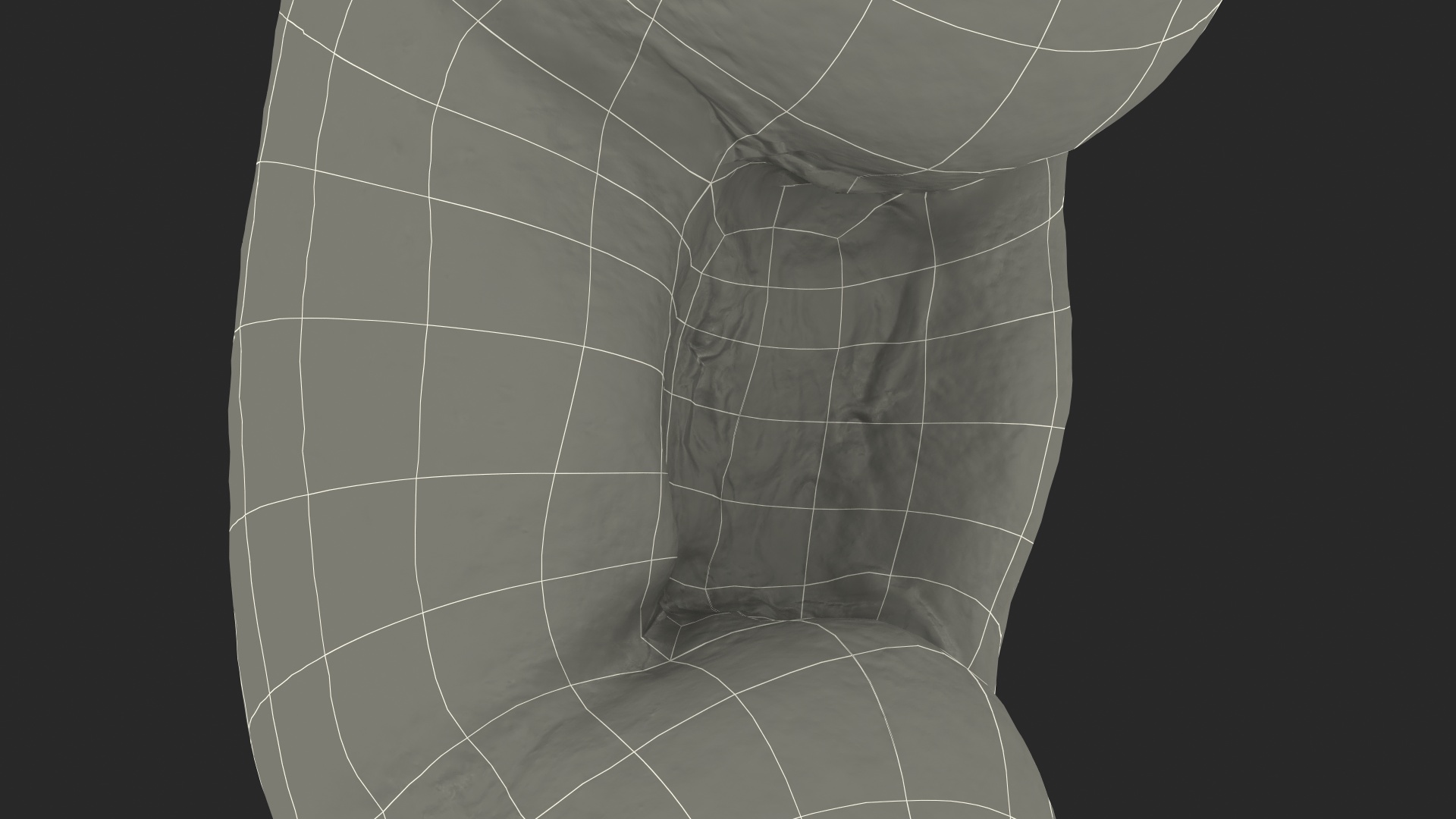 Human Kidney 3D