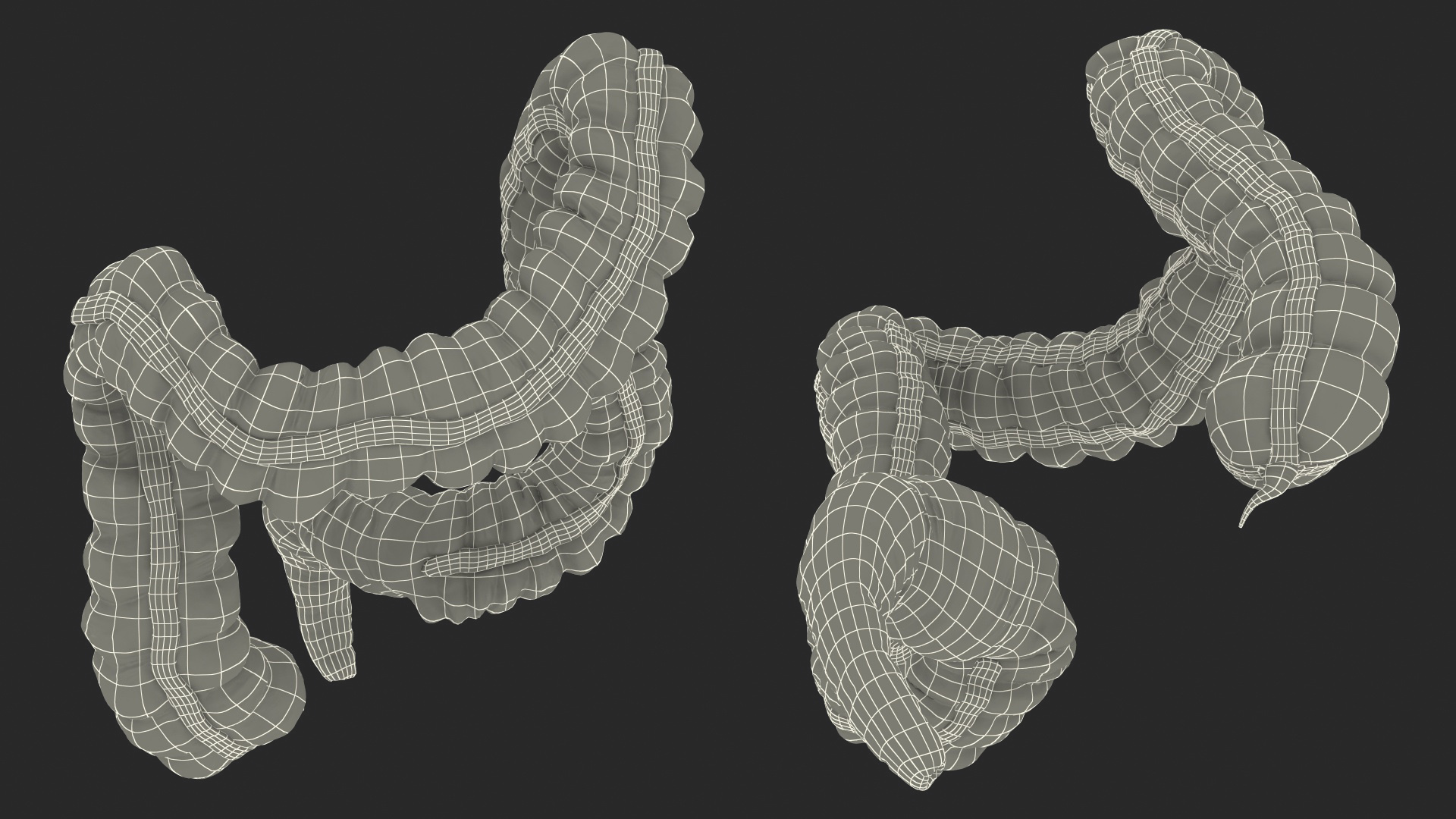 3D Human Colon