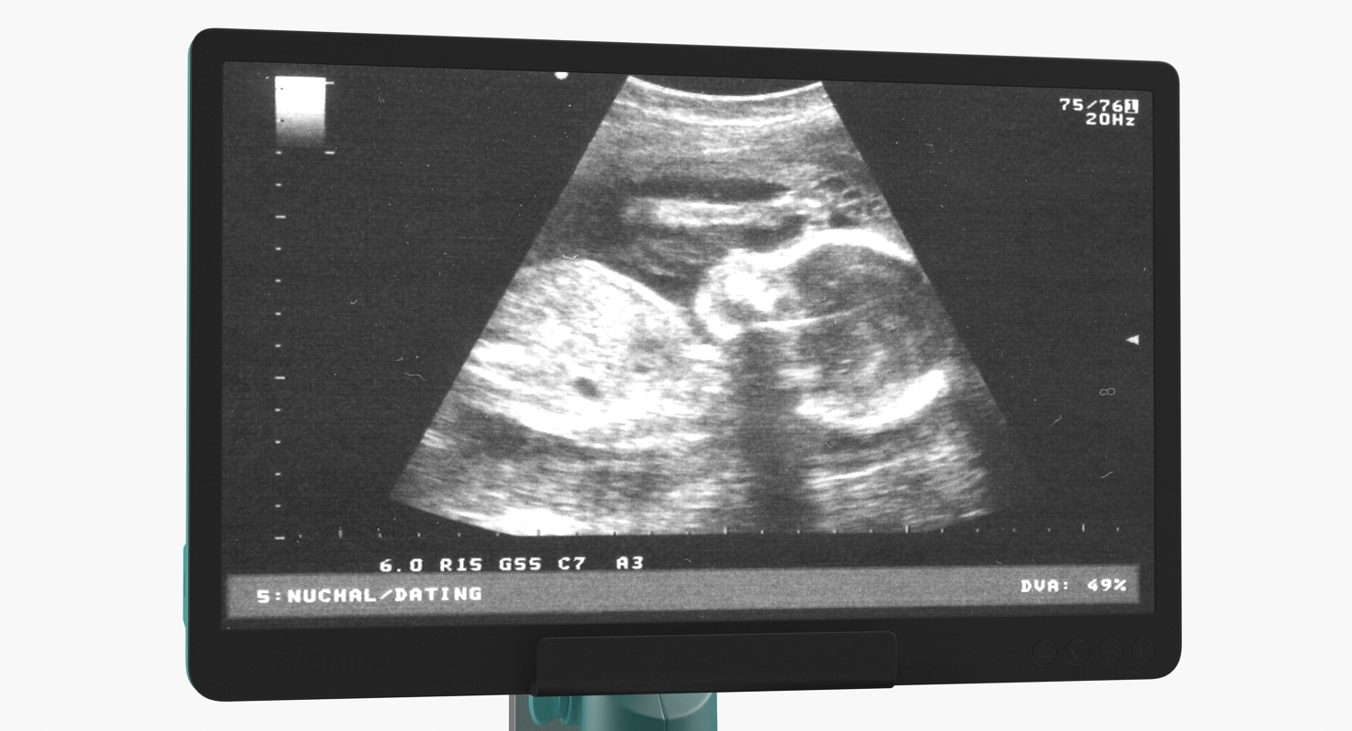 3D Ultrasound Machine Generic Rigged model