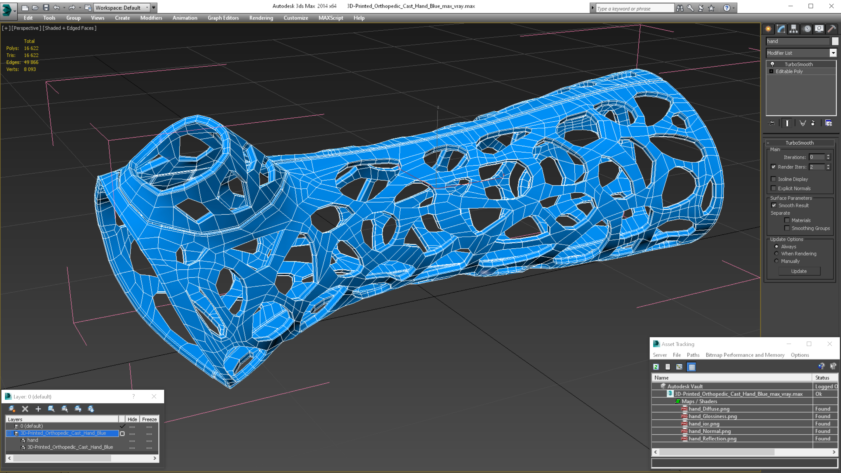 3D 3D-Printed Orthopedic Cast Hand Blue