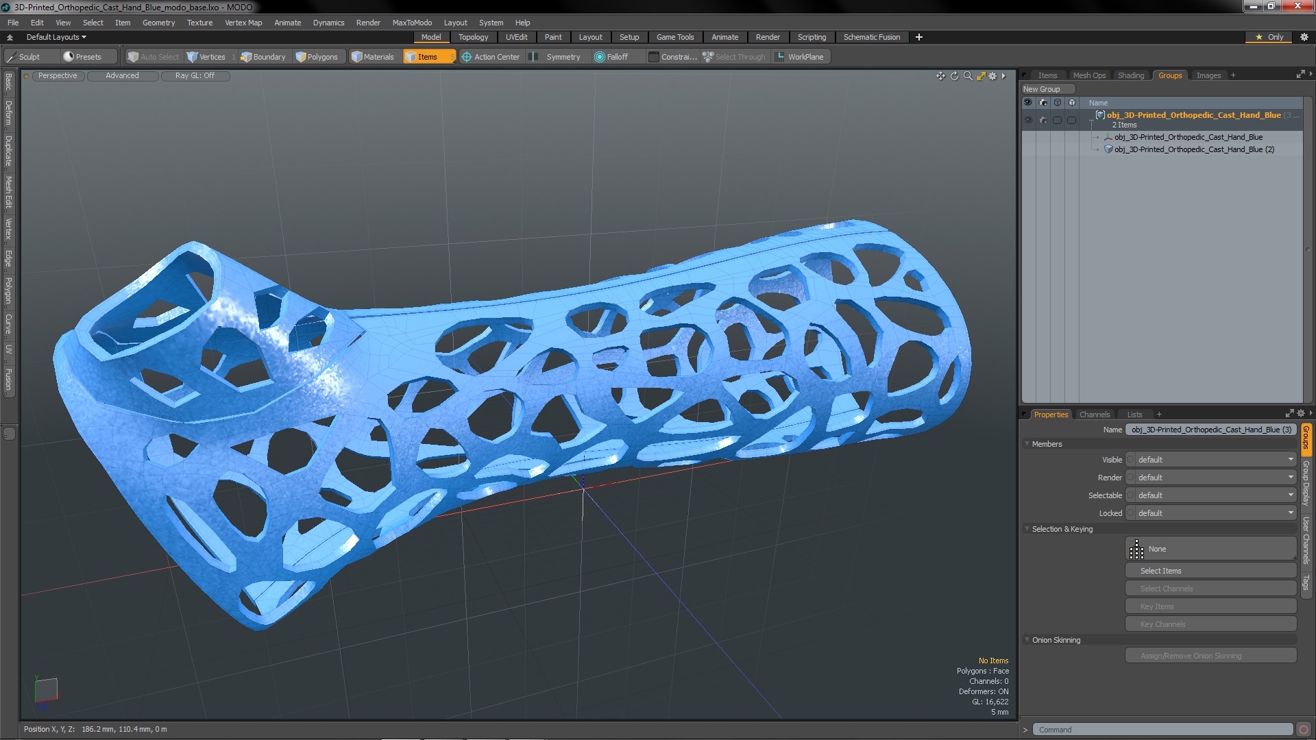 3D 3D-Printed Orthopedic Cast Hand Blue