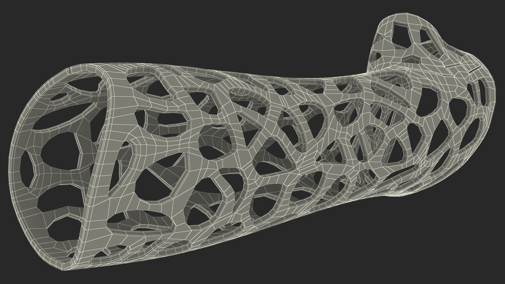3D 3D-Printed Orthopedic Cast Hand Blue