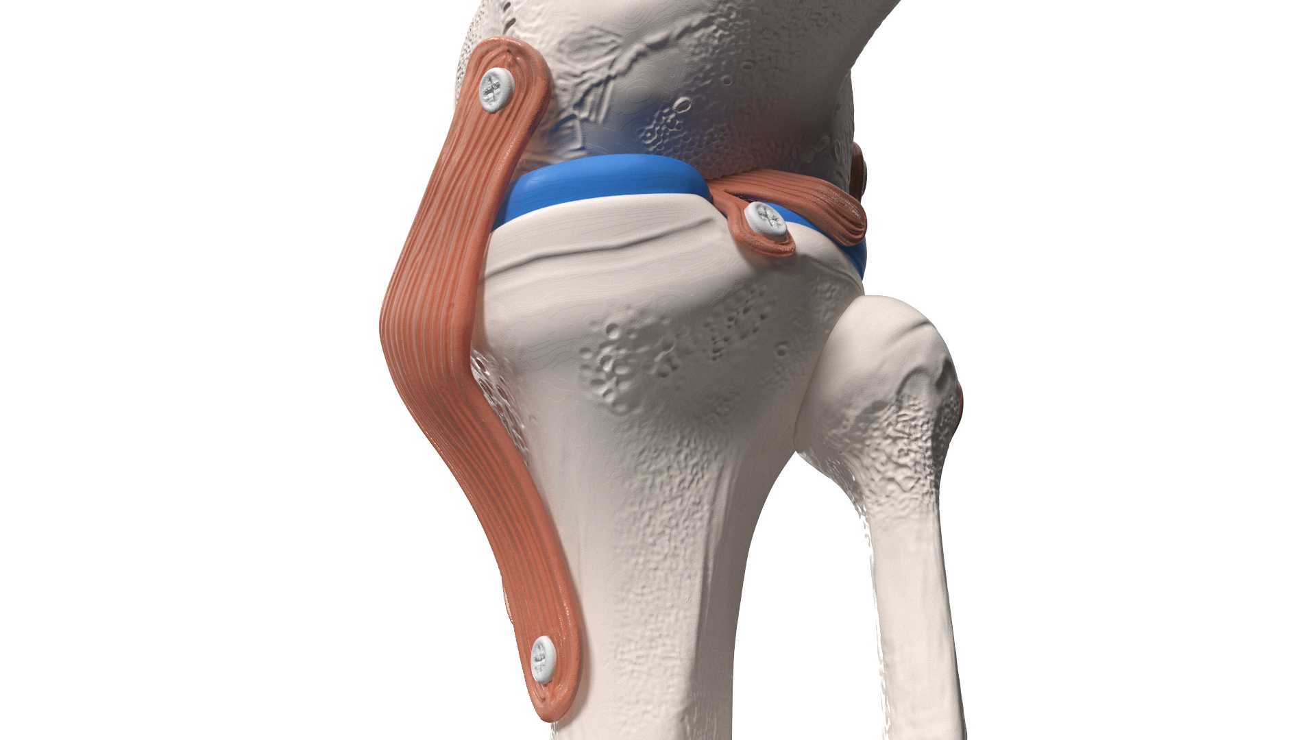 3D model Knee Joint Model in Flexed Position